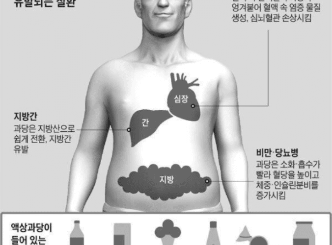 대사증후군주의단계